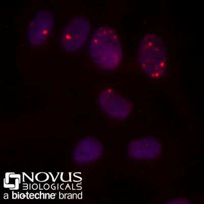 HeLa cells were fixed for 10 minutes using 10% formalin and then permeabilized for 5 minutes using 1X PBS + 0.5% Triton-X100.  The cells were incubated with 53BP1 Antibody conjugated to DyLight 550 (Catalog #NB100-304R) at 10ug/ml for 1 hour at room temperature.  Nuclei were counterstained with DAPI (Blue). Cells were imaged using a 40X objective.